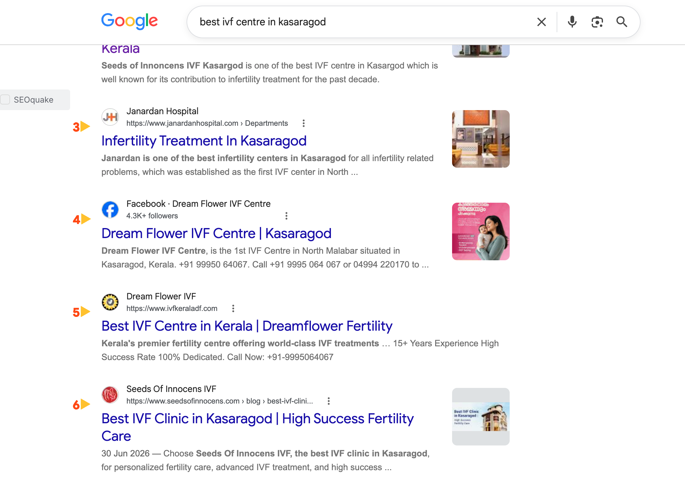 Dream Flower IVF Centre: Website and social search presence — Google Search · Organic results